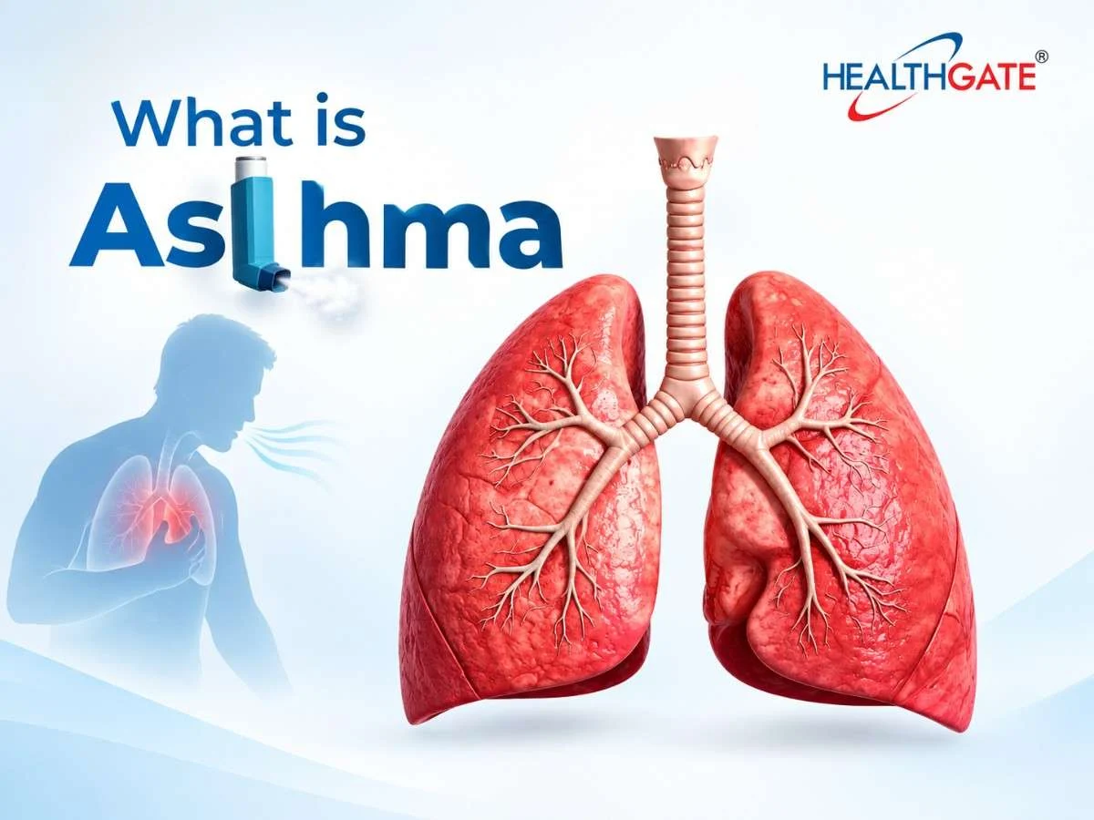 what is asthma