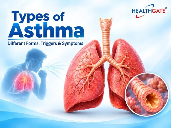 Types of Asthma
