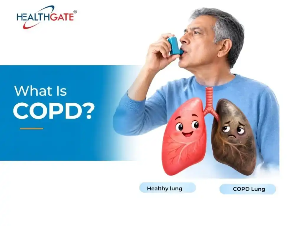 what is copd
