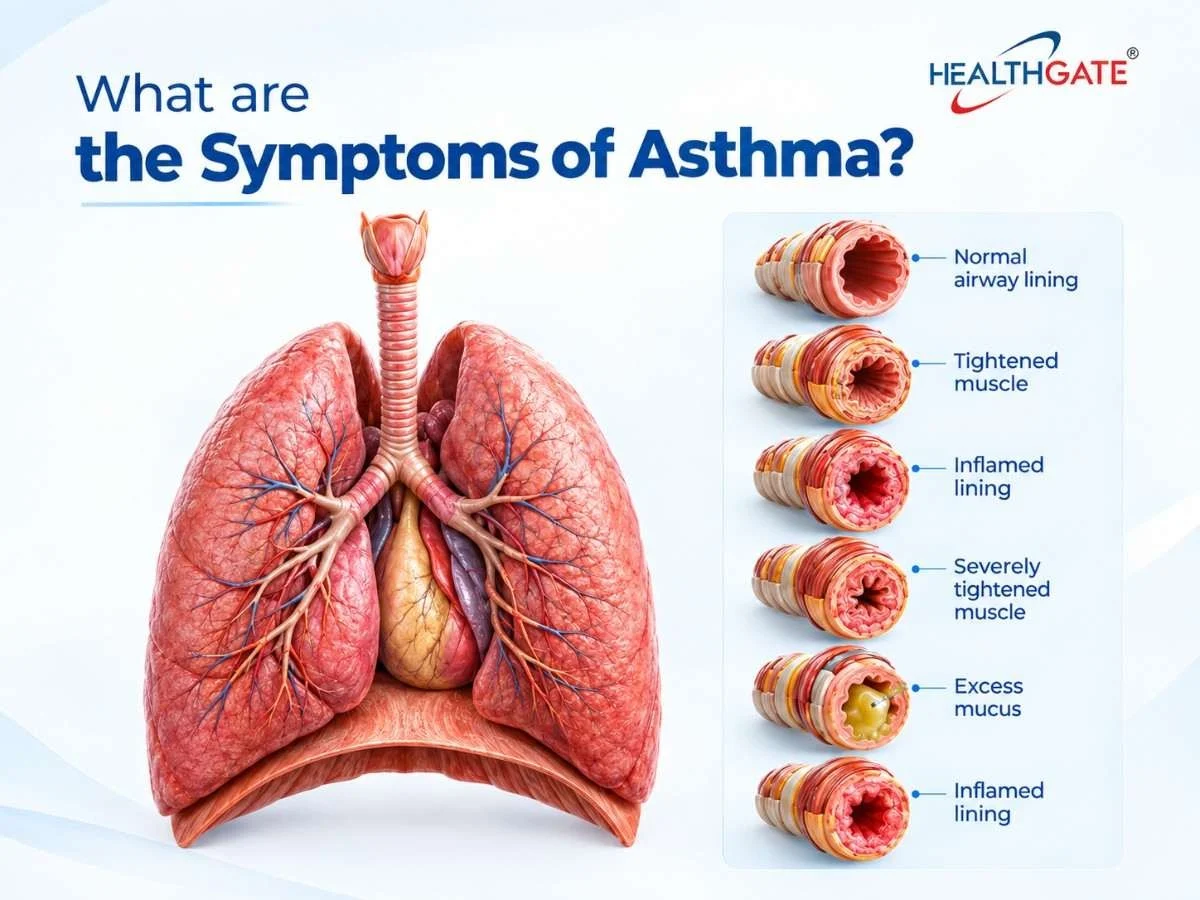 What Are the Symptoms of Asthma?