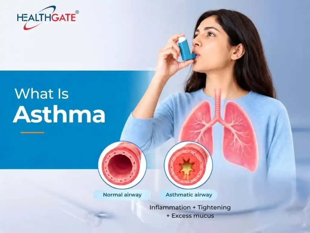 what is asthma
