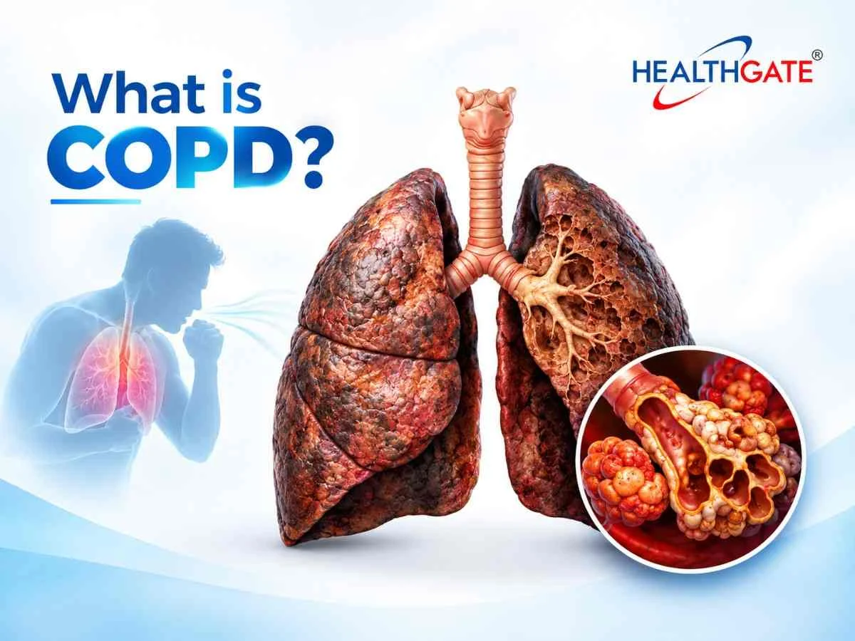 what is COPD